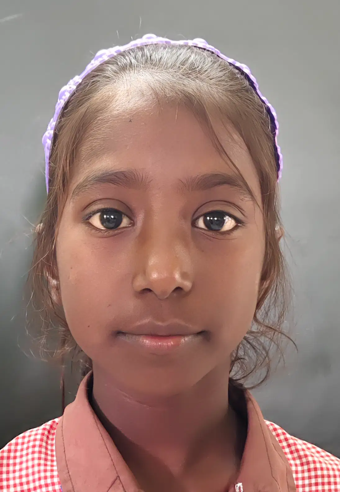 Media Image