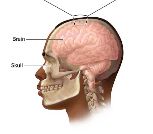 media image