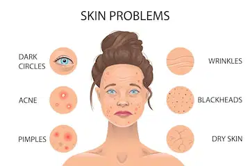 COMMON SKIN PROBLEMS Quiz