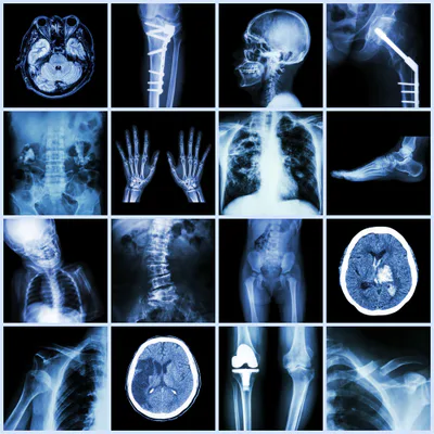 media