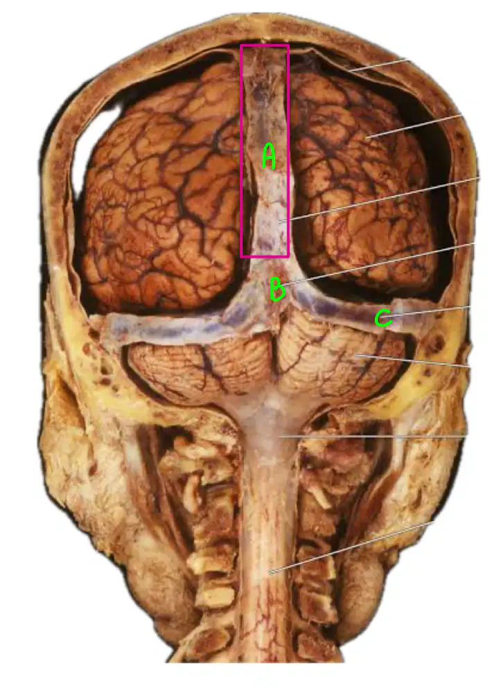 media image