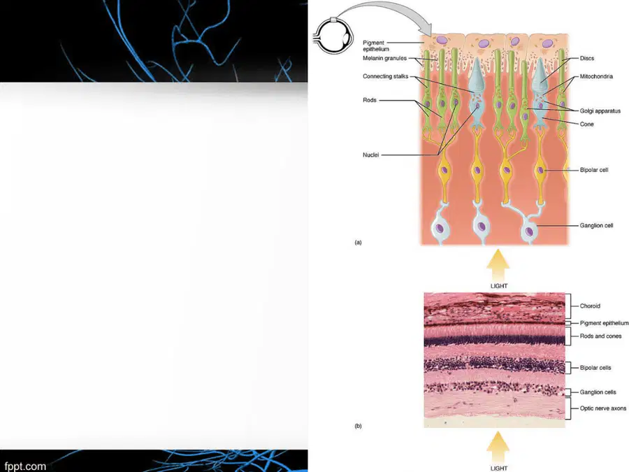 media