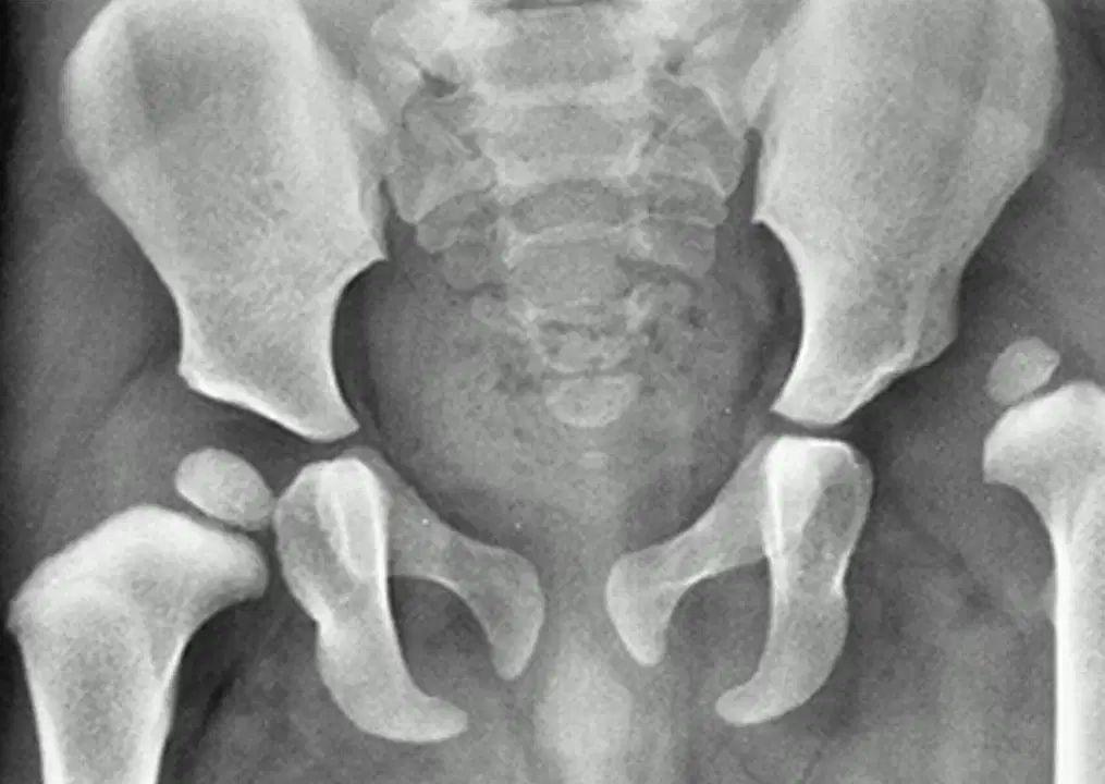 Peds Ortho OITE Review 2024 Quiz
