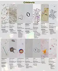 Cristales Urinarios Professional Development Flashcard Quizizz