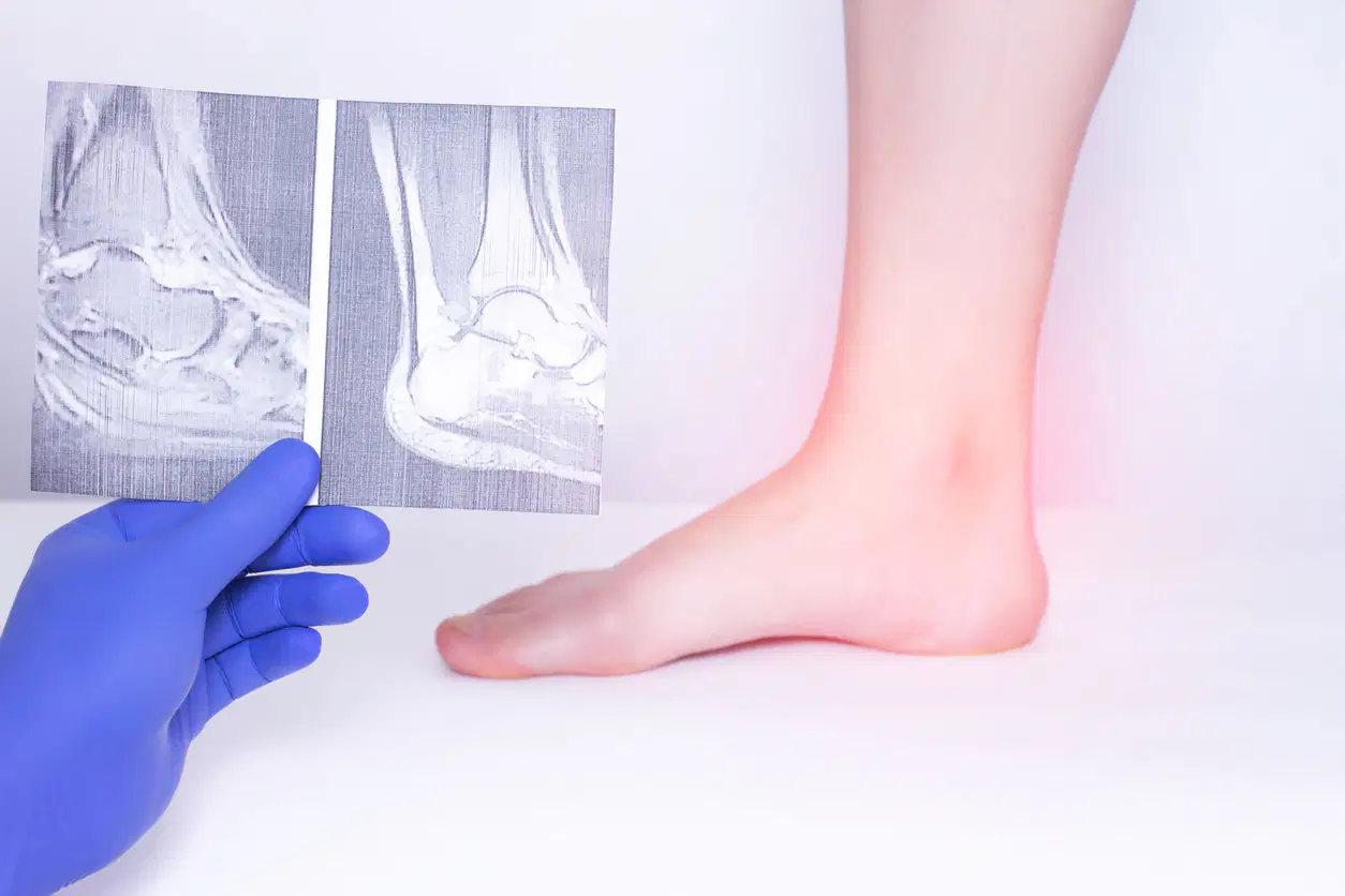 Ankle/ Lower leg Quiz