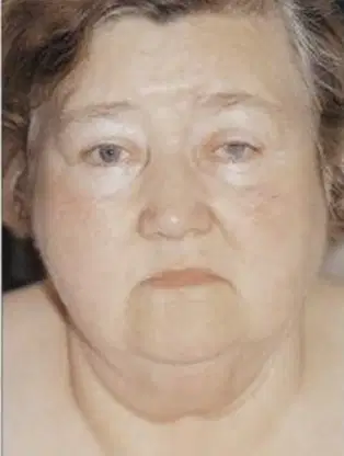 Media Image