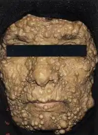 Media Image