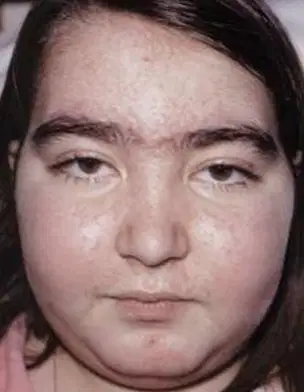 Media Image