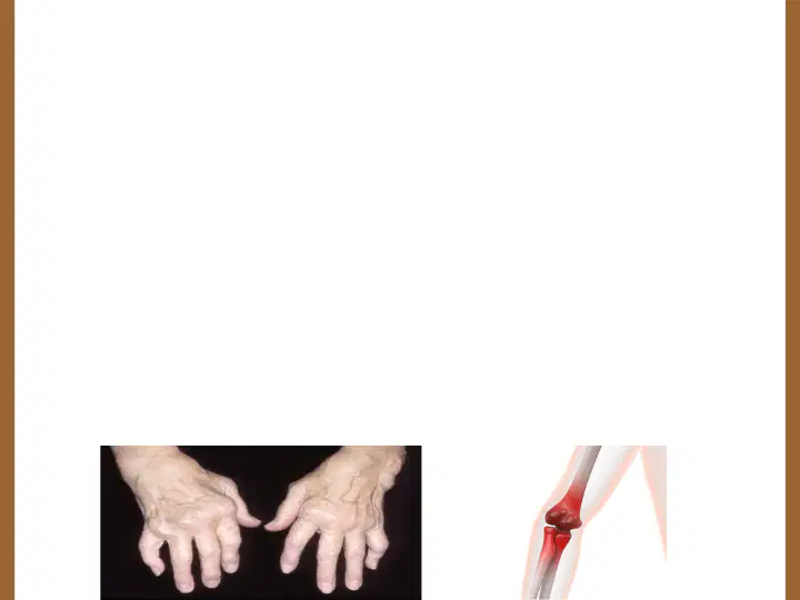 media