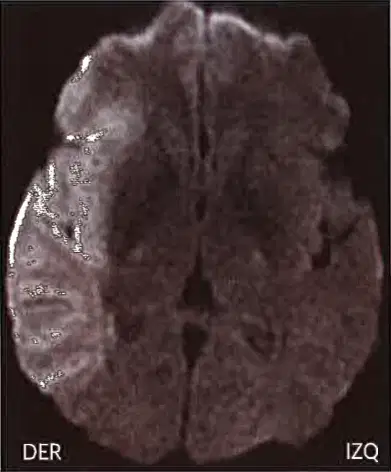 media image
